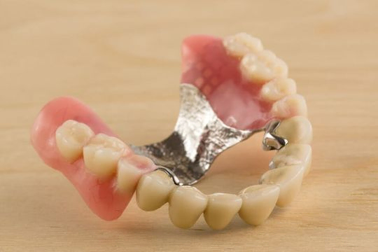dentadura con prótesis fija