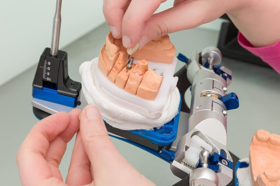 protésico creando prótesis con tornillo